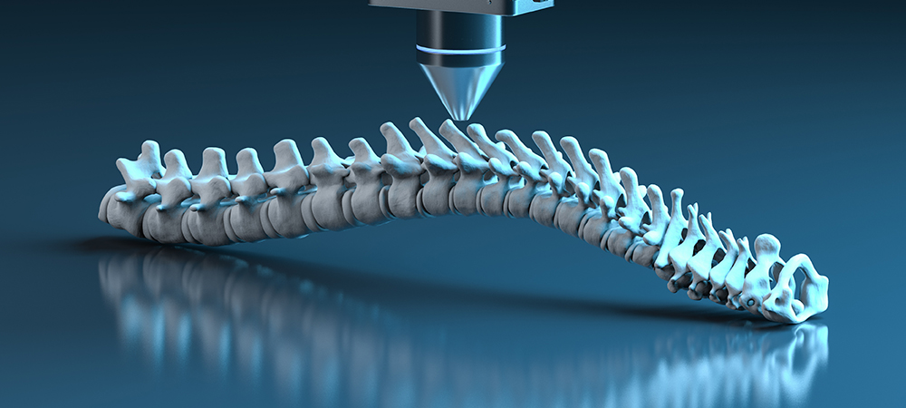 How HSS is using technology to improve spinal surgeries in the US 