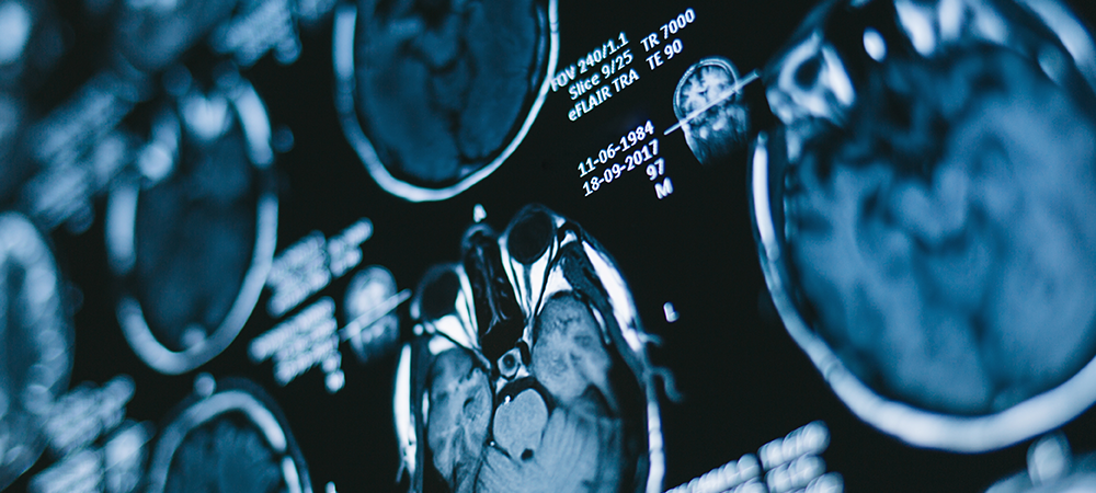 First ZAP-X gyroscopic radiosurgery treatments commence in France