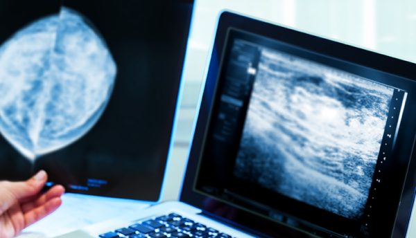 Mammography Associate apprentices reach 100 across England