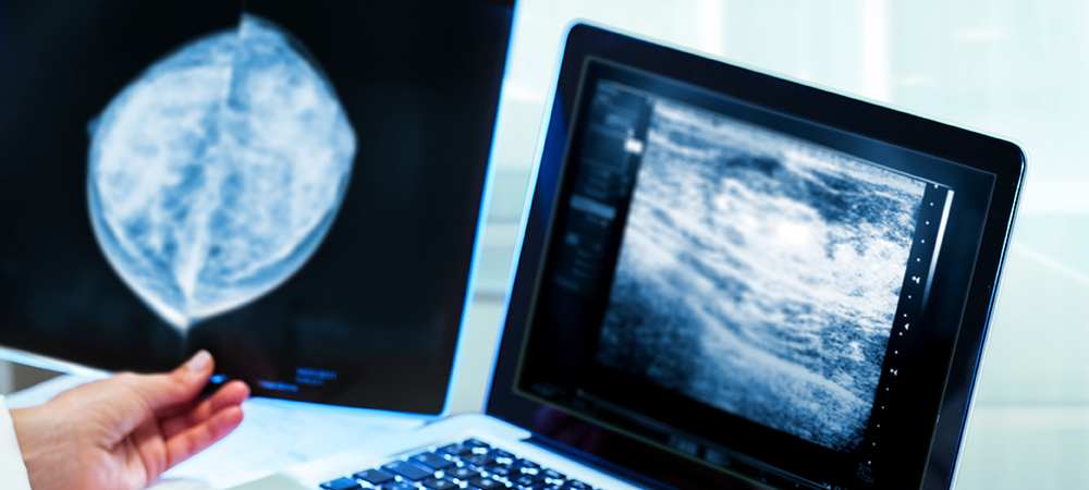 Mammography Associate apprentices reach 100 across England
