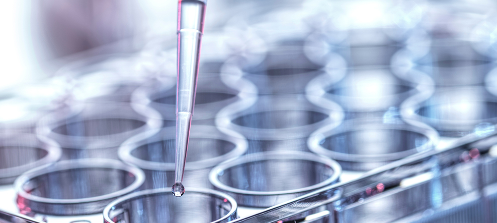 The transformative impact of Generative AI on life sciences ...