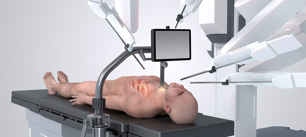 Scottish company makes key global breakthrough in robot-assisted heart surgery  