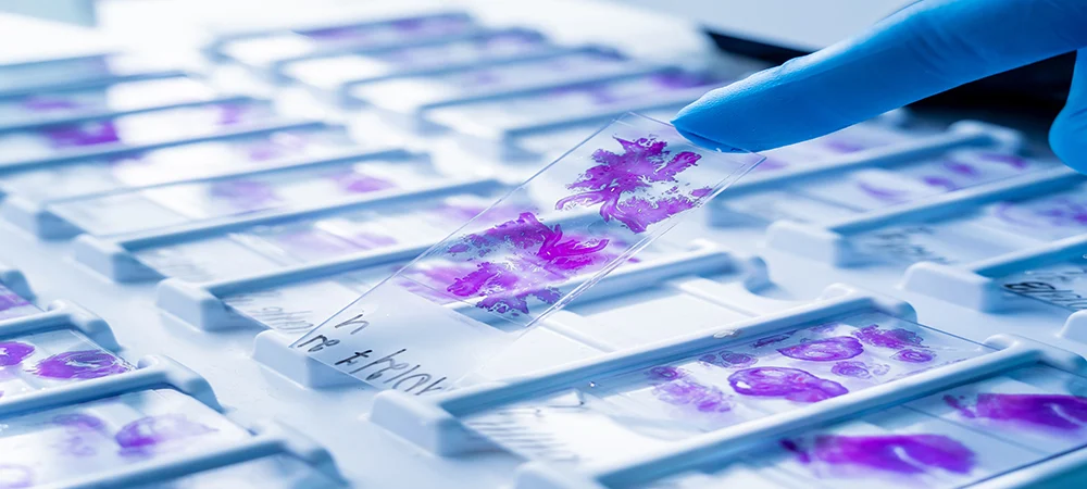 Hyland and Tribun Health partner to deliver next-generation, intelligent digital pathology  
